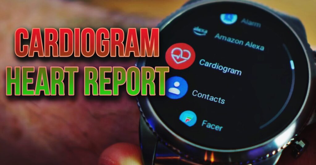 cardiogram