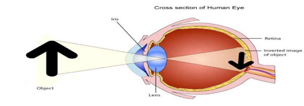 image shown inside eye